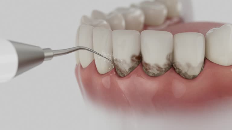Reliable Dental contractor in Lennox, SD by Smile Center Dentistry